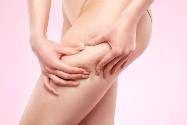Pourquoi la cellulite apparaît sur les cuisses ?
