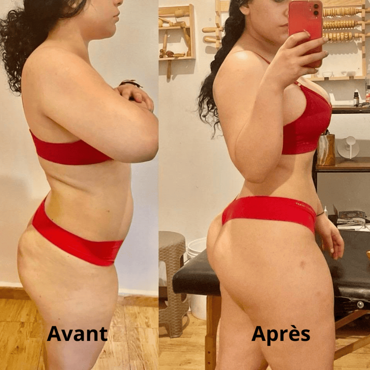 Kit madérothérapie 5 pièces