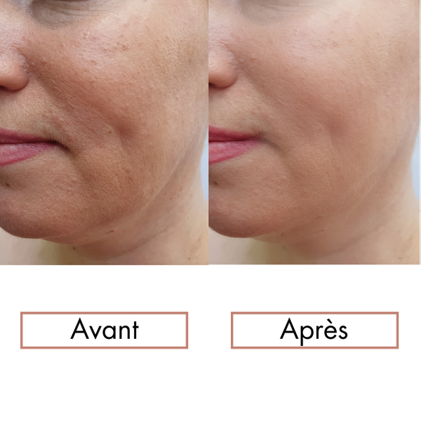 Kit Maderothérapie Faciale + automassage en vidéo